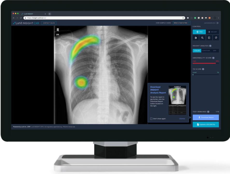 元宇宙如何通過VR、AR、5G進行AI超級醫生